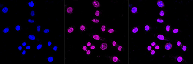 HSF1 Antibody in Immunocytochemistry (ICC/IF)