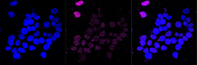 DNA Ligase IV Antibody in Immunocytochemistry (ICC/IF)