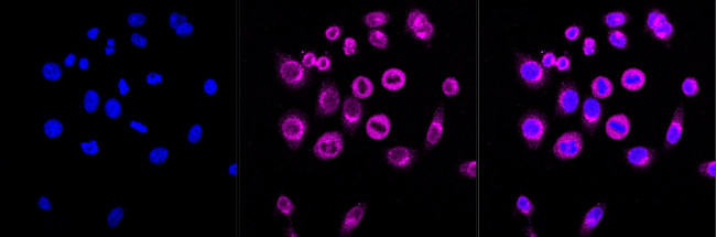 LMAN1 Antibody in Immunocytochemistry (ICC/IF)