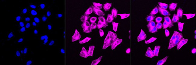 LOXL2 Antibody in Immunocytochemistry (ICC/IF)