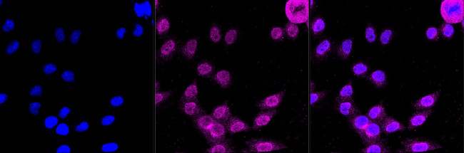 LRP8 Antibody in Immunocytochemistry (ICC/IF)