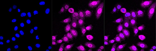 MAPKAPK2 Antibody in Immunocytochemistry (ICC/IF)