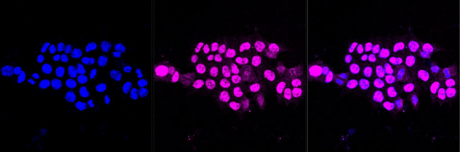 MAPKAPK2 Antibody in Immunocytochemistry (ICC/IF)