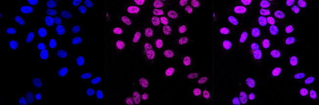 MCM3 Antibody in Immunocytochemistry (ICC/IF)