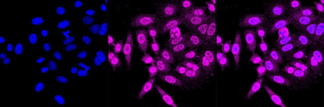 LIS1 Antibody in Immunocytochemistry (ICC/IF)