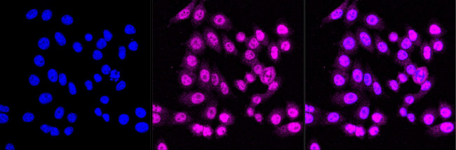 PPM1G Antibody in Immunocytochemistry (ICC/IF)