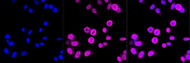 PRMT7 Antibody in Immunocytochemistry (ICC/IF)