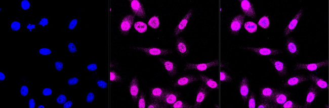 SMAD5 Antibody in Immunocytochemistry (ICC/IF)