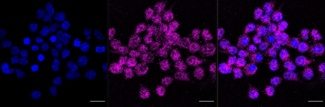 STIM1 Antibody in Immunocytochemistry (ICC/IF)