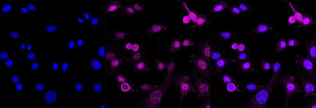 MUNC18 Antibody in Immunocytochemistry (ICC/IF)