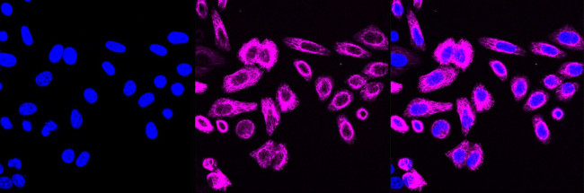 WNT5A Antibody in Immunocytochemistry (ICC/IF)