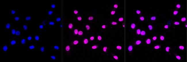 MYST2 Antibody in Immunocytochemistry (ICC/IF)