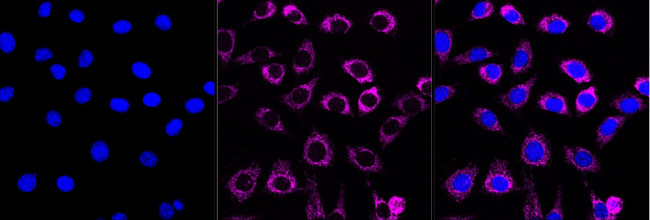 ACAA2 Antibody in Immunocytochemistry (ICC/IF)