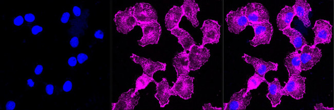 ARPC2 Antibody in Immunocytochemistry (ICC/IF)