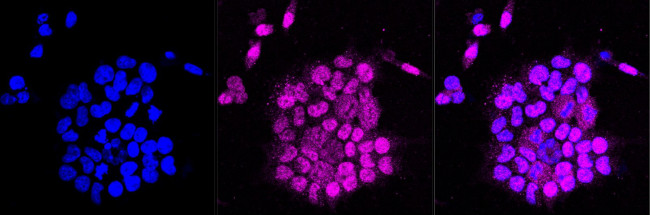 HEAB Antibody in Immunocytochemistry (ICC/IF)