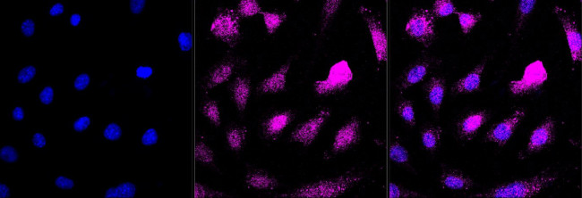 AP2M1 Antibody in Immunocytochemistry (ICC/IF)