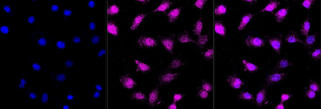 ATG4B Antibody in Immunocytochemistry (ICC/IF)