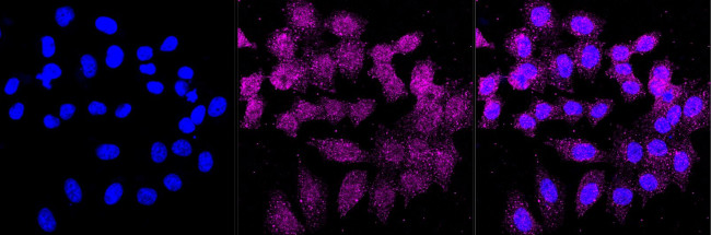 Caspase 2 Antibody in Immunocytochemistry (ICC/IF)