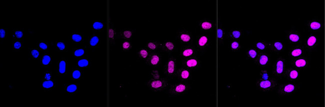 Cyclin E2 Antibody in Immunocytochemistry (ICC/IF)