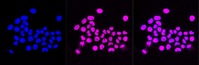 BAZ1B Antibody in Immunocytochemistry (ICC/IF)