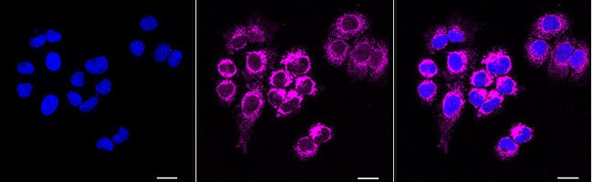 C1QBP Antibody in Immunocytochemistry (ICC/IF)