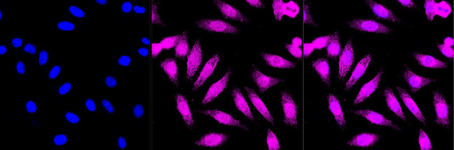 CLASP1 Antibody in Immunocytochemistry (ICC/IF)