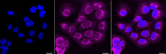 ATG16L1 Antibody in Immunocytochemistry (ICC/IF)