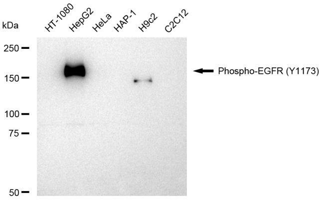 Phospho-EGFR (Tyr1173) Antibody in Western Blot (WB)