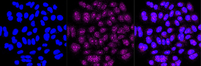 ATP7B Antibody in Immunocytochemistry (ICC/IF)