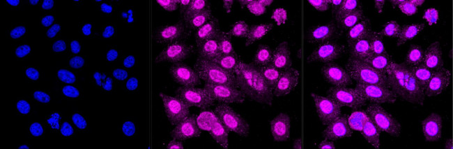 APPL1 Antibody in Immunocytochemistry (ICC/IF)