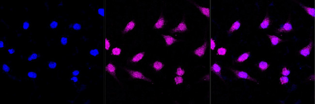 IFT88 Antibody in Immunocytochemistry (ICC/IF)