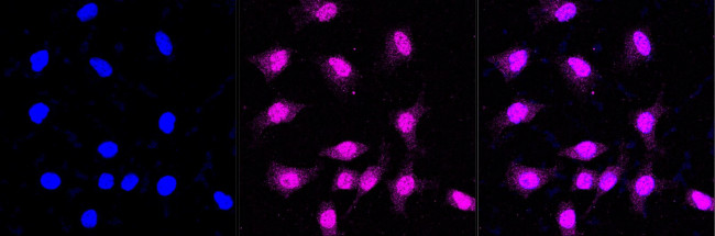 IQGAP2 Antibody in Immunocytochemistry (ICC/IF)