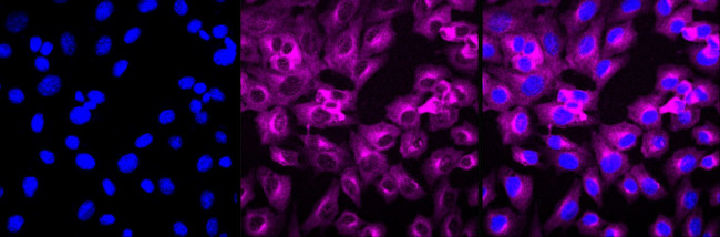 Kinesin 5B Antibody in Immunocytochemistry (ICC/IF)