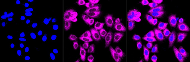 Phospho-GYS1 (Ser641) Antibody in Immunocytochemistry (ICC/IF)