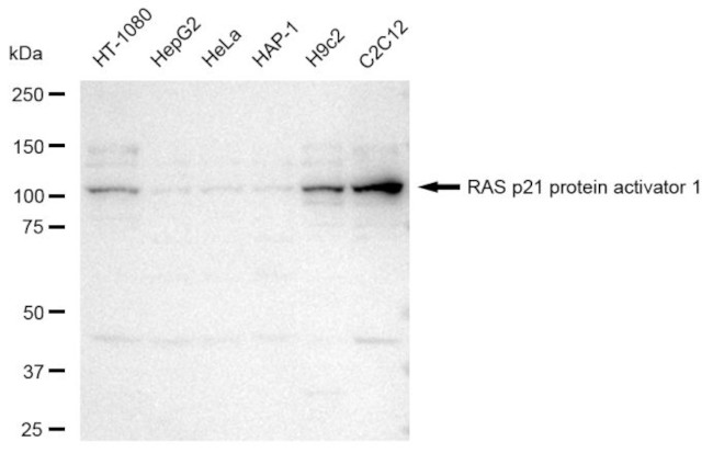 RASA1 Antibody in Western Blot (WB)