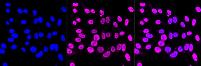 Phospho-STAT1 (Ser727) Antibody in Immunocytochemistry (ICC/IF)