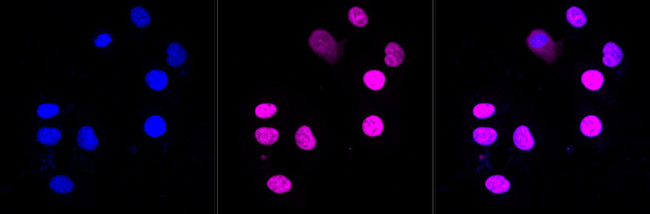 SPT5 Antibody in Immunocytochemistry (ICC/IF)