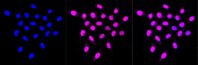 TRIM24 Antibody in Immunocytochemistry (ICC/IF)