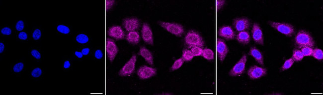 ATG4C Antibody in Immunocytochemistry (ICC/IF)