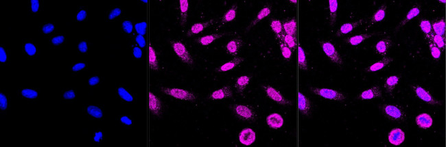 Caspase 2 Antibody in Immunocytochemistry (ICC/IF)