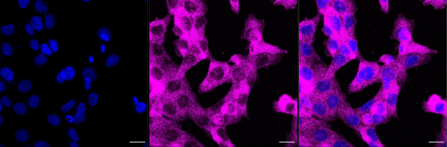 CTPS Antibody in Immunocytochemistry (ICC/IF)