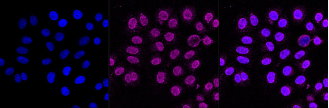 Nicastrin Antibody in Immunocytochemistry (ICC/IF)