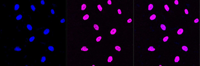 H3K27ac Antibody in Immunocytochemistry (ICC/IF)