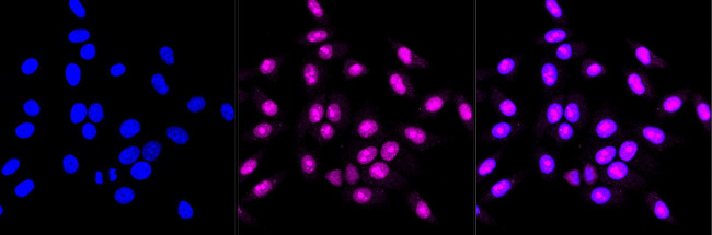 HMGB2 Antibody in Immunocytochemistry (ICC/IF)