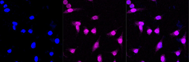 p38 MAPK Antibody in Immunocytochemistry (ICC/IF)