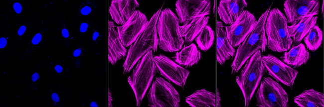 OXGR1 Antibody in Immunocytochemistry (ICC/IF)