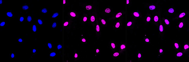 QKI Antibody in Immunocytochemistry (ICC/IF)