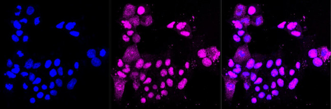 RAD51 Antibody in Immunocytochemistry (ICC/IF)