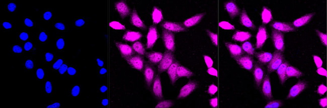 SMS Antibody in Immunocytochemistry (ICC/IF)