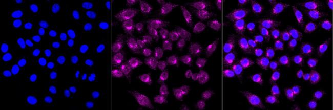 STX16 Antibody in Immunocytochemistry (ICC/IF)